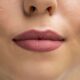 lip flip before and after