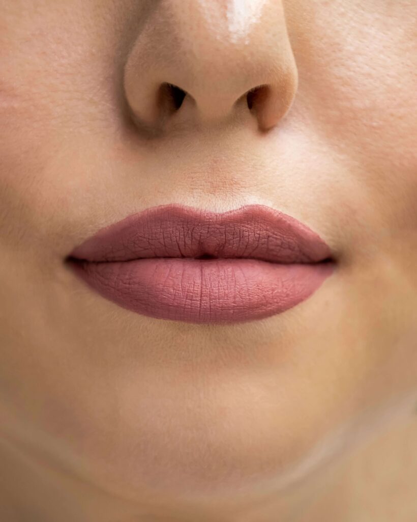 lip flip before and after