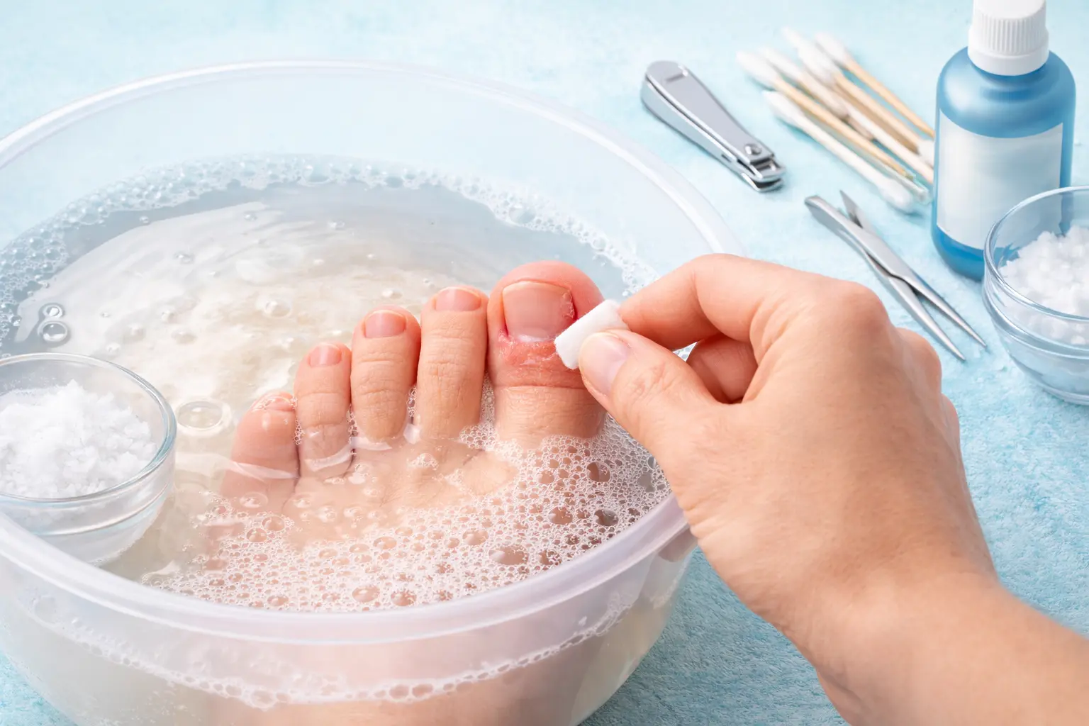 Soaking foot in warm salt water for mild ingrown toenail healing